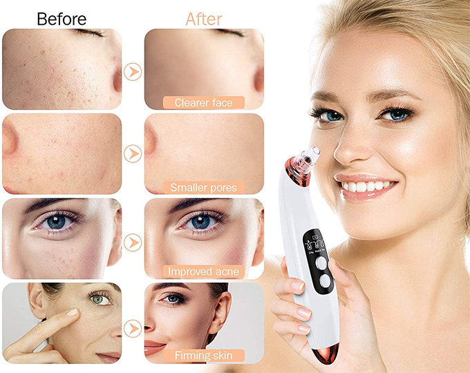Electric Facial Pore Cleanser
